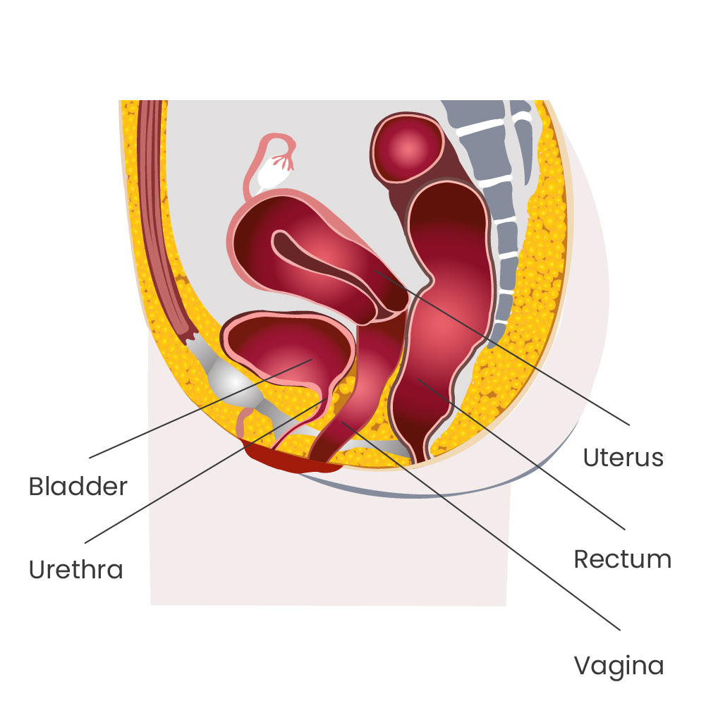 Vaginal prolapse: Causes and treatment options